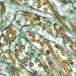 another-person-has-died-of-bird-flu--but-this-time-its-a-new-strain