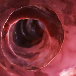 colon_0