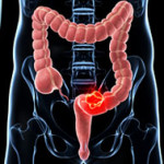 C_17_canaleCittadino_24_paragrafi_paragrafo_0_immagine