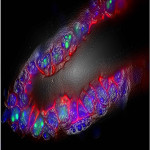 p53 and ARF in Cell Reports