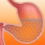 attiva-anti-obesity-pill