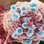 vaccino-cancro-al-seno