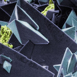 Kidney stone primary