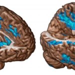 pictures-for-molecular-psychiatry