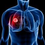 112086037_large_stadiirakalegkih1