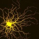 retinal-ganglion-cell