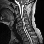 N0036715 3T MRI of a human head and neck