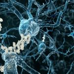 beta-amyloid-plaques