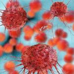 breast-cancer-cells