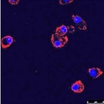 cystic-fibrosis-gene-edit (1)