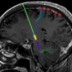 howdeepbrain