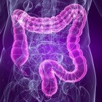 irritable-bowel-syndrome-natural-cure-remedies