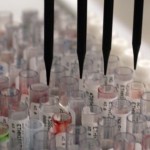 Prenatal Testing for Genetic Mutations