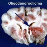 f10888a1306510069620