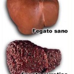 CIRROSI-EPATICA-OK-Copia