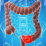 C_17_canaleCittadino_184_paragrafi_paragrafo_0_immagine