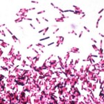 660_clostridium_difficile