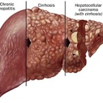 francescoquatraro_HCC-01