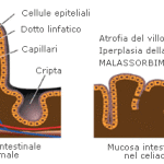 malassorbimento