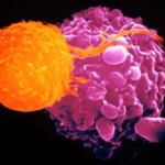 cellula_cancro_linfoma