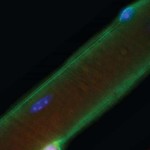 duchennemusc