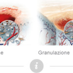 wound-healing-process