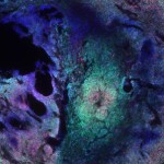 murine-stem-cell-derived-brain-tumor