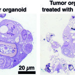 Tumor+cells_mid
