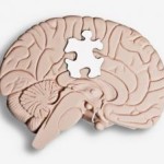 autistic-brain-puzzle