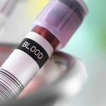 o-BLOOD-TEST-facebook
