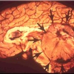 090medblast.195220842_std