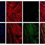 Muscle+cells+with+and+without+dystrophin_mid