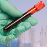 blood-in-a-test-tube