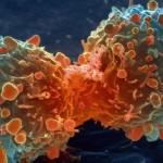 _83307904_m1320644-lung_cancer_cell_division,_sem-spl