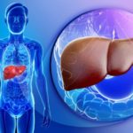 body-site-and-blow-up-of-liver
