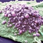 CancerCell