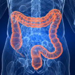 111colon-hydrotherapy1