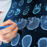 brain-scan