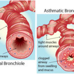Asthma-healthcare-online.org_