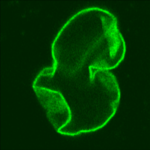 Progeria_cell (1)