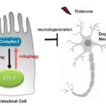 3-parkinsonsdi