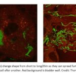 e coli bacteria in bladder wall credit Thomas Emil Andersen SDU