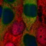 hela-cells-transfected-with-stat2
