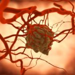 tumor-surrounded-by-blood-vessels