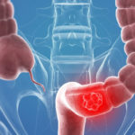 1446128447_56322dc8445d8