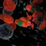 160111_h05a0_rci-therapie_sn635