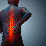 3-problems-with-chronic-pain-and-how-medicinal-marijuana-can-help