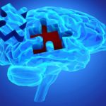 illustration-of-the-brain-with-a-jigsaw-piece-missing
