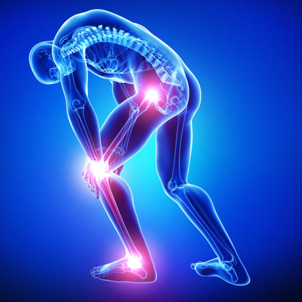 Fibromialgia: scoperto il collegamento tra DNA e dolore articolare cronico diffuso fibromialgia