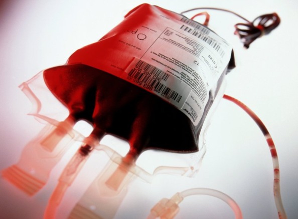 Pretrattare i globuli rossi con l’ossido nitrico può ridurre gli effetti collaterali legati alle trasfusioni trasfusioni